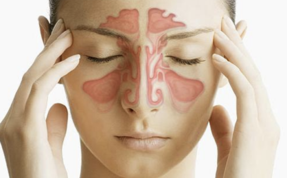 Capul doare vederea proastă, Mariana LUȚA: ”Migrena nu-i o simplă durere de cap”