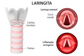 Cum se pune diagnosticul pentru crupul laringian