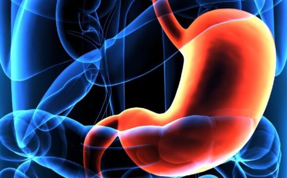 Acidul Gastric - Care este Rolul Acestuia în Organism? Ce poți face când nivelul de acid gastric crește sau scade?
